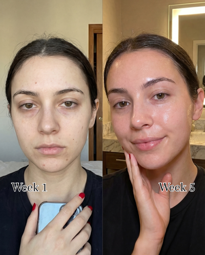 Peaché - One Ingredient. Glowing Skin.