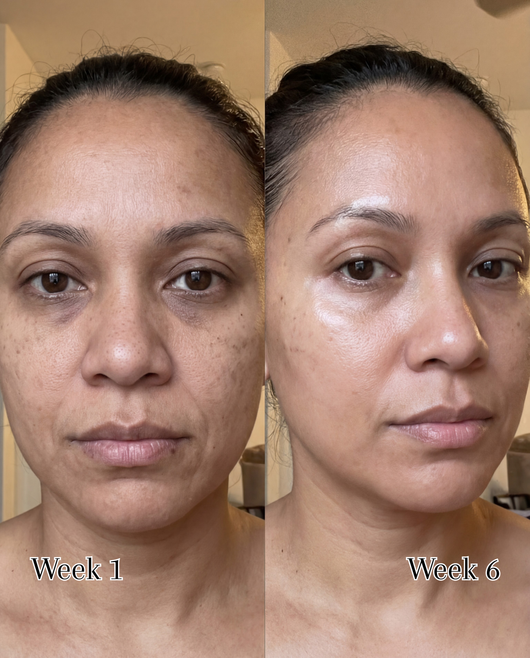 Peaché - One Ingredient. Glowing Skin.