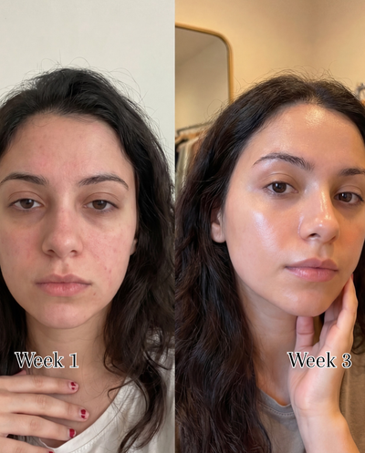 Peaché - One Ingredient. Glowing Skin.