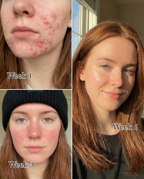 Peaché - One Ingredient. Glowing Skin.