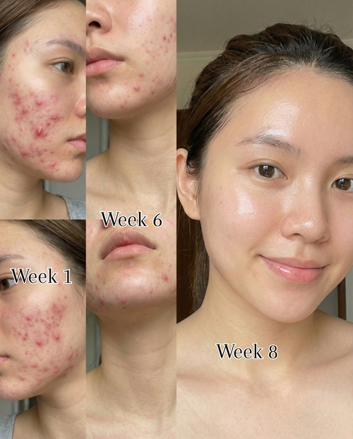 Peaché - One Ingredient. Glowing Skin.