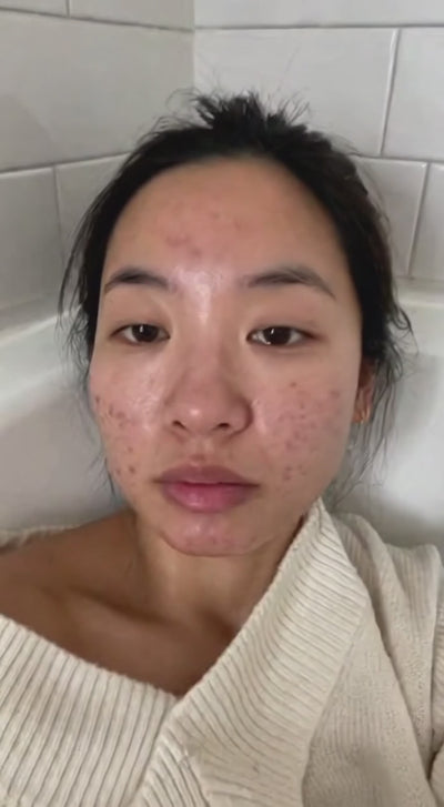 Peaché - One Ingredient. Glowing Skin.